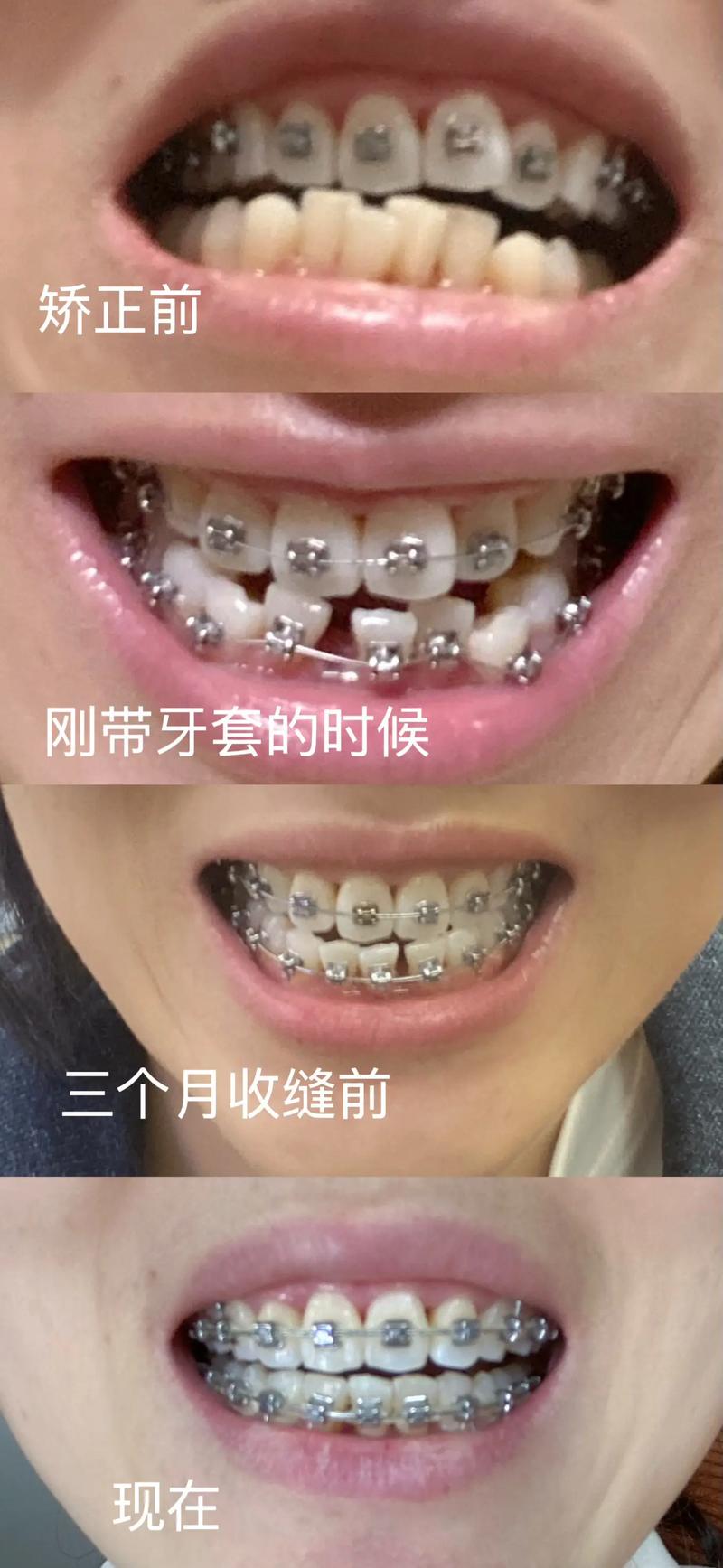 聚焦大邑口腔诊所：守护健康笑容的新篇章