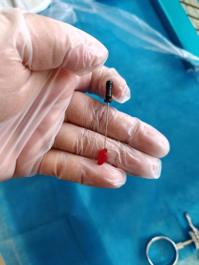大邑牙科：守护口腔健康的秘密武器