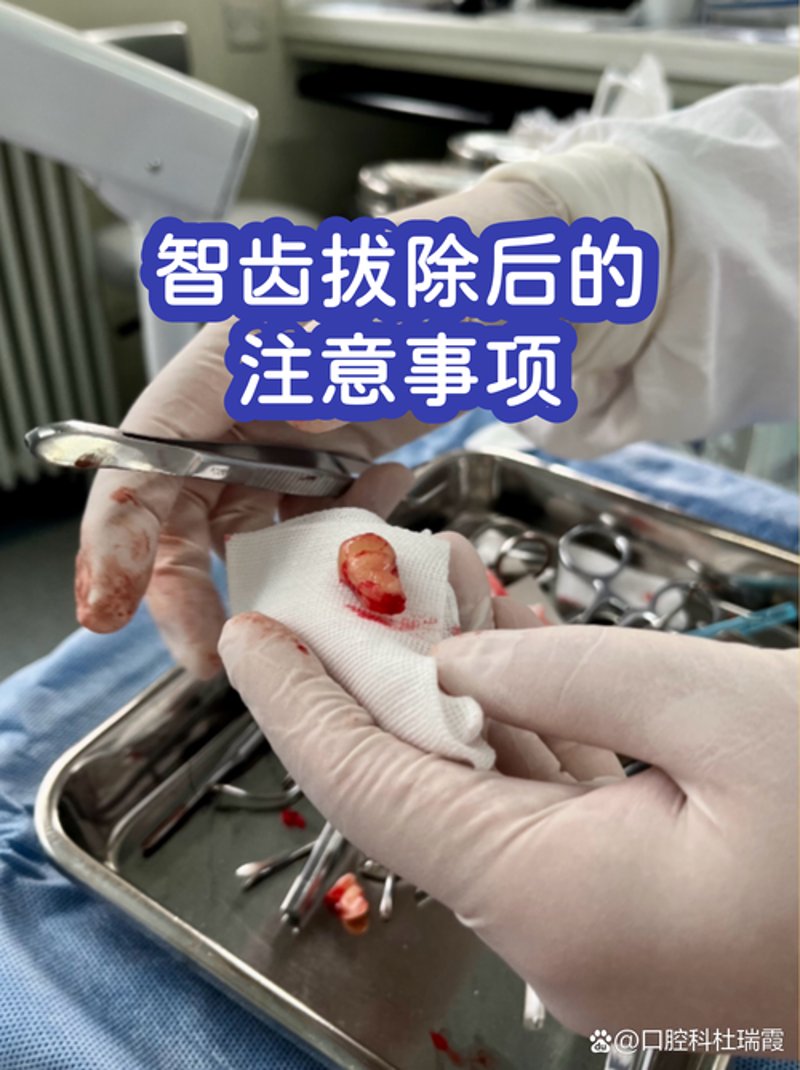 大邑口腔诊所:守护你的笑容